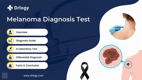 melanoma test at home